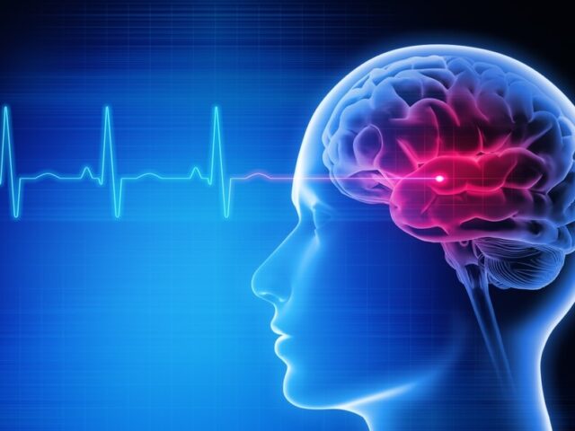 Kako prepoznati cerebrovaskularne bolesti na vreme?