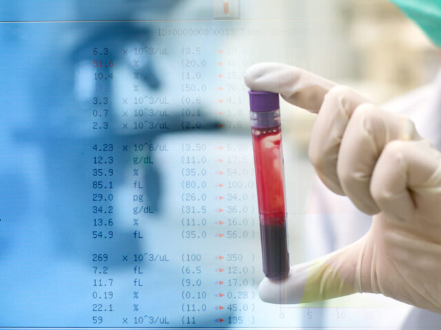 Koje laboratorijske analize je potrebno uraditi jednom godišnje?