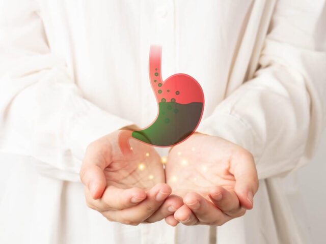 Refluks (GERB) – Kada kiselina peče i kako to zaustaviti