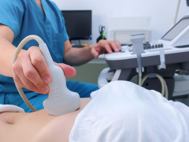 Kada i zašto se radi ultrazvuk abdomena – kompletan vodič za pregled